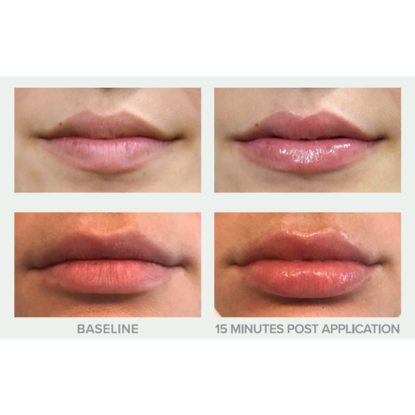 HYDRA POUT + PROTECT HA+PEPTIDE LIP TREATMENT