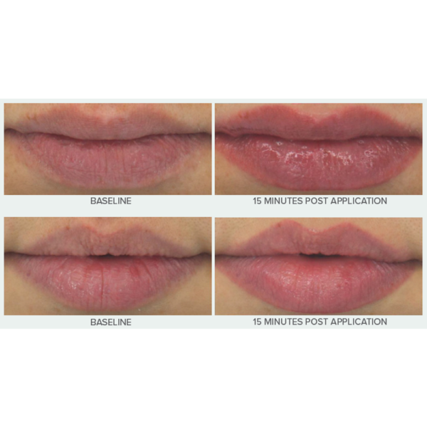 HYDRA POUT + PROTECT HA+PEPTIDE LIP TREATMENT